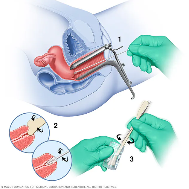 A picture of an operating procedure for the removal of a tooth.